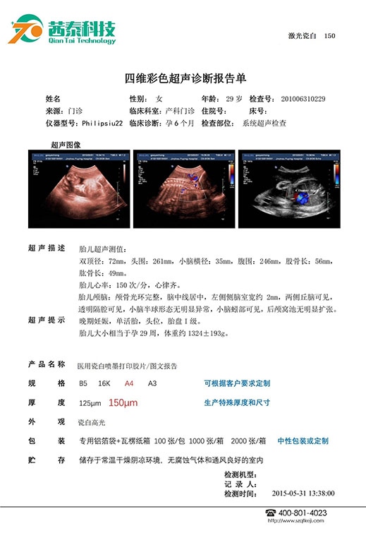 醫(yī)用超聲膠片